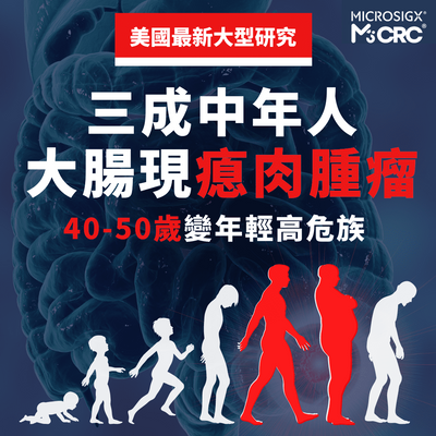 美國大型研究：三成中年人 大腸現瘜肉腫瘤