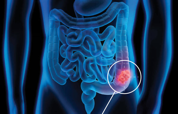 Medical image